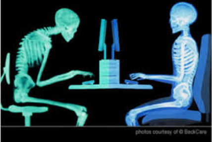 poor posture skeleton motionworx blog